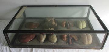 19th vitrine anatomisch wassen hoofd en organen dronkaard beschikbaar voor biedingen