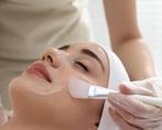Acne model gezocht, Overige uren, MBO, Starter, Overige vormen
