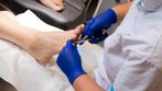 pedicure, Ophalen