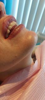 BB LIPS, Sieraden, Tassen en Uiterlijk, Uiterlijk | Mondverzorging, Ophalen of Verzenden, Nieuw, Lipbalsem