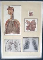 Grote anatomische Schoolplaat de longen / ademhaling, Antiek en Kunst, Antiek | Schoolplaten, Ophalen of Verzenden, Natuur en Biologie