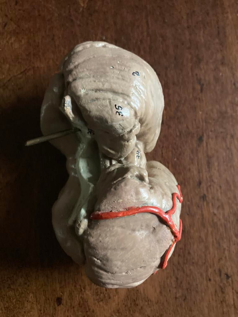 Vintage Anatomisch schildklier Model - Medisch Onderwijs, Ophalen of Verzenden, Gebruikt