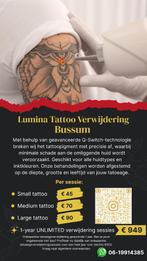 Tattoo verwijdering via laser, Ophalen, Nieuw, Overige typen