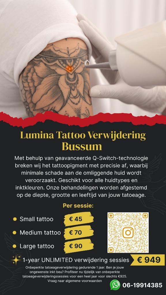 Tattoo verwijdering via laser, Sieraden, Tassen en Uiterlijk, Uiterlijk | Lichaamsverzorging, Nieuw, Overige typen, Ophalen