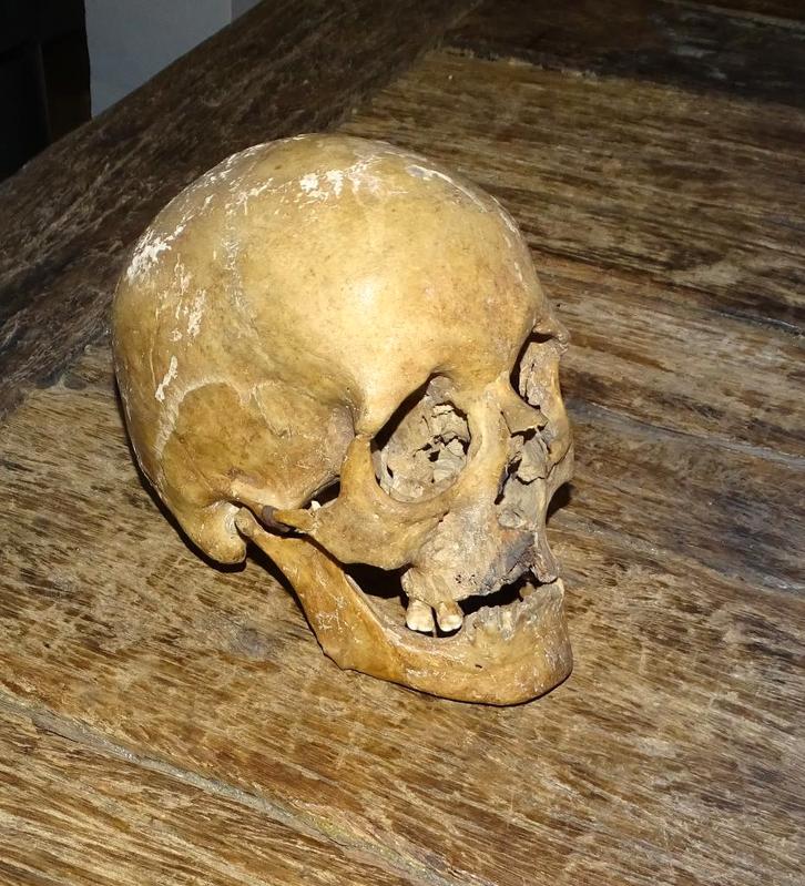 echte menselijke schedel uit franse school, Antiek en Kunst, Curiosa en Brocante, Ophalen