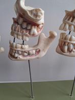 Medisch model Somso, Antiek en Kunst, Curiosa en Brocante, Ophalen of Verzenden