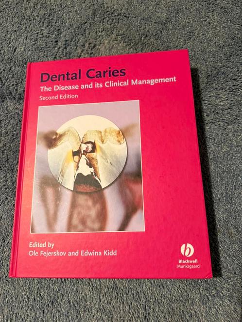 Dental Caries – The Disease and its Clinical Managemen, Boeken, Studieboeken en Cursussen, Zo goed als nieuw, WO, Ophalen of Verzenden