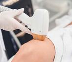 Diode Ice Laser ontharing voor de zomer!, Ophalen, Zo goed als nieuw, Wit, Toebehoren