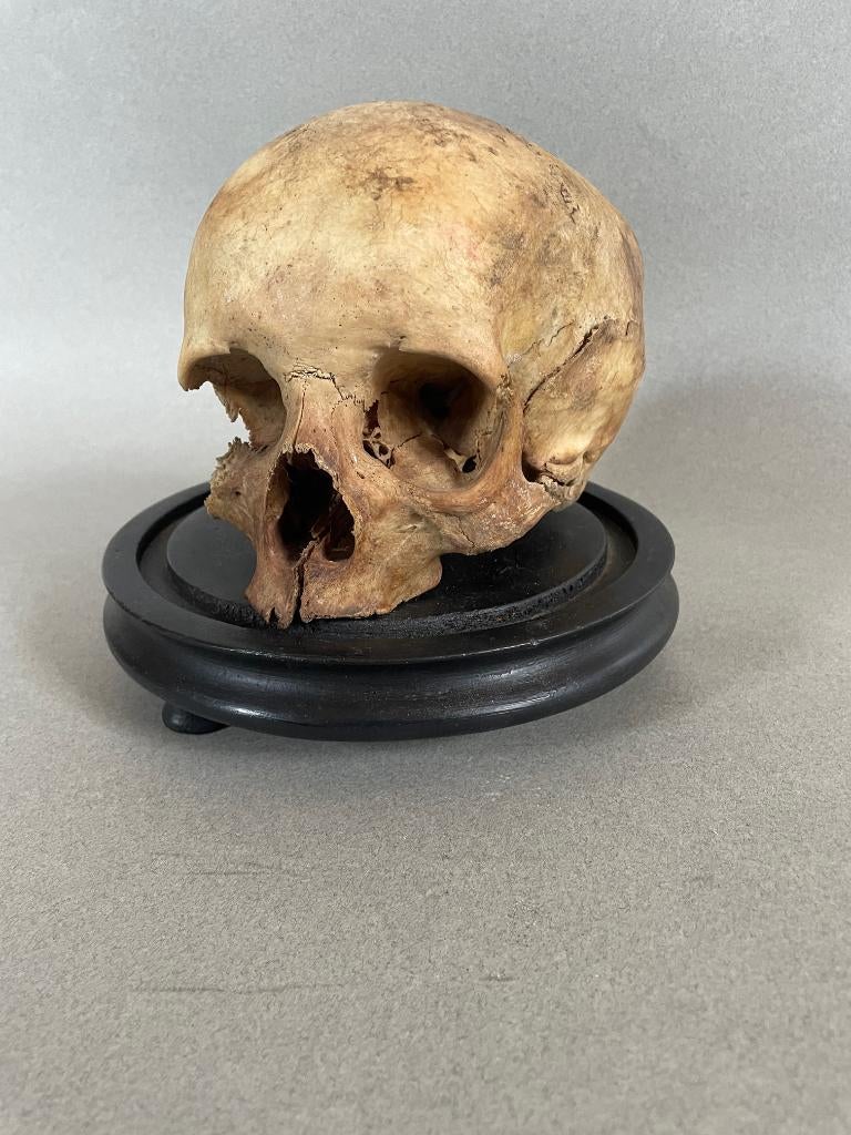 Antieke mensenschedel voor wetenschappelijke doeleinden, Antiek en Kunst, Ophalen of Verzenden