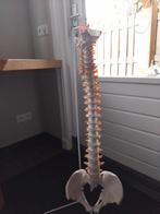 Anatomisch model wervelkolom met beschadigingen, Ophalen of Verzenden, Gelezen, Niet van toepassing