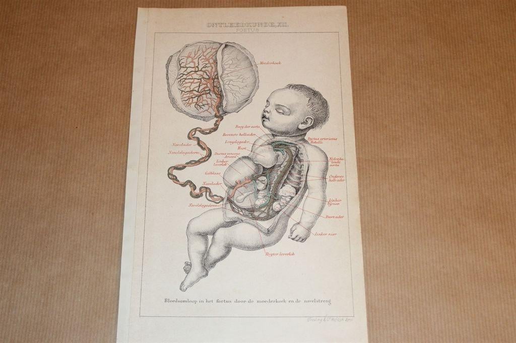 Antieke anatomische kleurenprent - Foetus [mens] 1875 !!, Ophalen of Verzenden, Voor 1940, Zo goed als nieuw, Overige onderwerpen