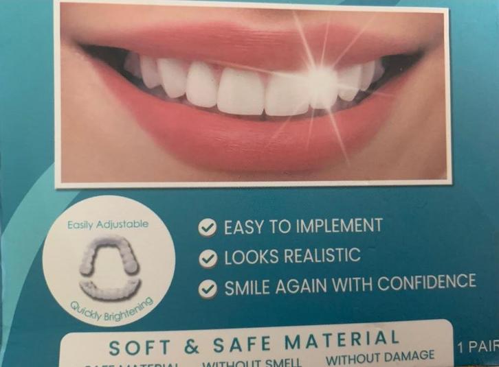 gebit tijdelijke oplossing, Diversen, Braces, Nieuw, Ophalen of Verzenden