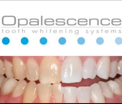 Tanden bleken Opalescence (16) bleekgel, Sieraden, Tassen en Uiterlijk, Uiterlijk | Mondverzorging, Nieuw, Overige typen, Ophalen of Verzenden