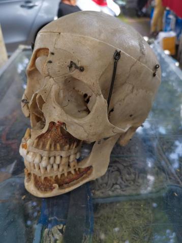 skelet doodskop voor Medici zeldzaam mooi gemaakt beschikbaar voor biedingen