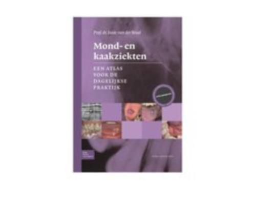 Mond- en kaakziekten 9789036816328, Boeken, Studieboeken en Cursussen, Zo goed als nieuw, HBO, Beta, Verzenden