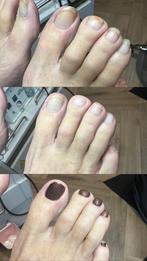 Pedicure behandeling, Ophalen of Verzenden, Nieuw, Overige typen