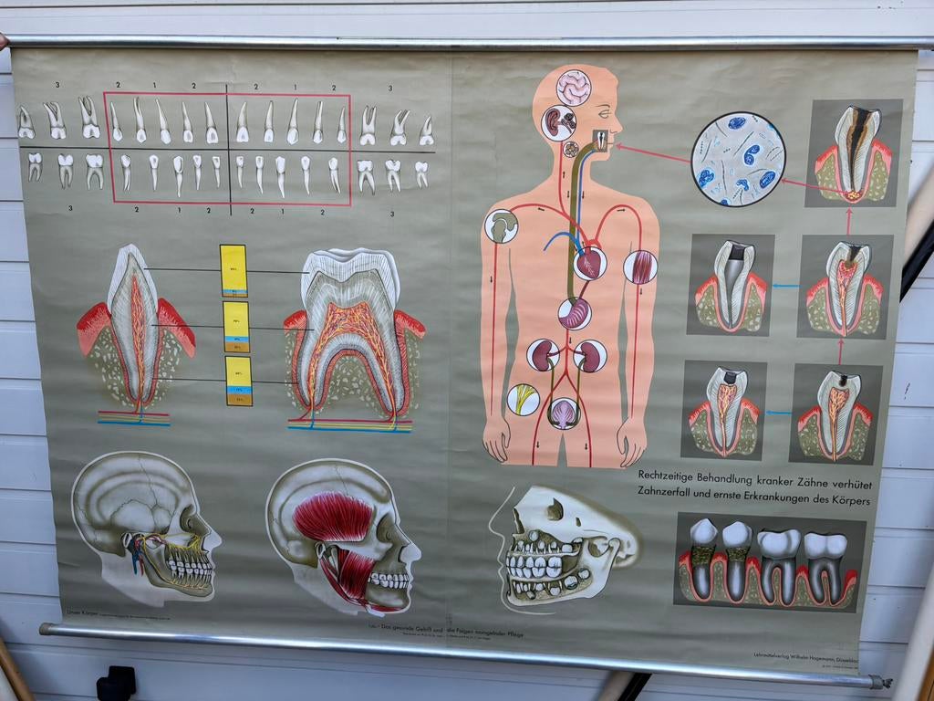 Oude schoolposters, Ophalen