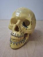 Medisch craniotomie schedelmodel met titanium plaatjes, Ophalen of Verzenden, Gebruikt