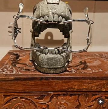 Mond Gag - Medisch Instrument (tanden model is niet te koop) beschikbaar voor biedingen