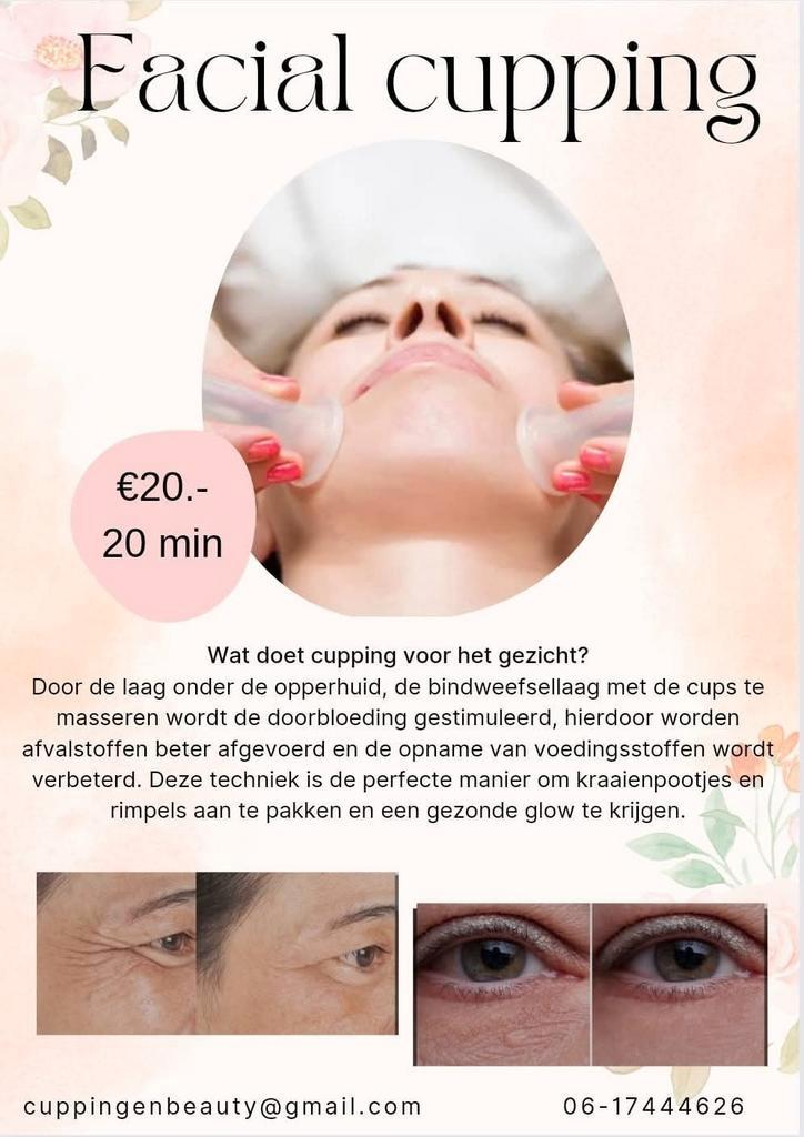 Cupping, Sieraden, Tassen en Uiterlijk, Uiterlijk | Lichaamsverzorging, Zo goed als nieuw, Overige typen, Ophalen of Verzenden