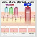 Laser Epilator - Ontharing - Epileren, Niet ingevuld, Niet ingevuld, Nieuw, Ophalen of Verzenden