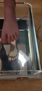 Podoscoop met lichtbalk voor de medisch pedicure, Ophalen, Gebruikt, Hand- en Voetverzorging