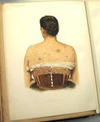 Atlas of Clinical Medicine Vol. 1&2 1892-3 Bramwell Medisch, Antiek en Kunst, Antiek | Boeken en Bijbels, Ophalen of Verzenden