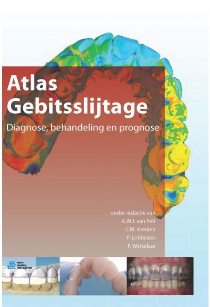 Atlas gebitsslijtage, Boeken, Verzenden, Nieuw, Diverse auteurs, Natuurwetenschap