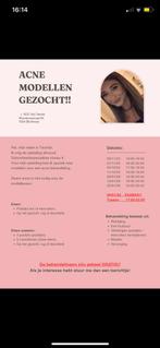 Acne modellen gezocht, Vacatures, Vacatures | Modellen, Variabele uren, MBO, Vanaf 1 jaar, Overige vormen