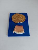 Anatomisch plakaat, Ophalen of Verzenden