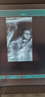 Echo voor hond of poes, 8 tot 15 weken, Meerdere, Meerdere dieren, Nederland