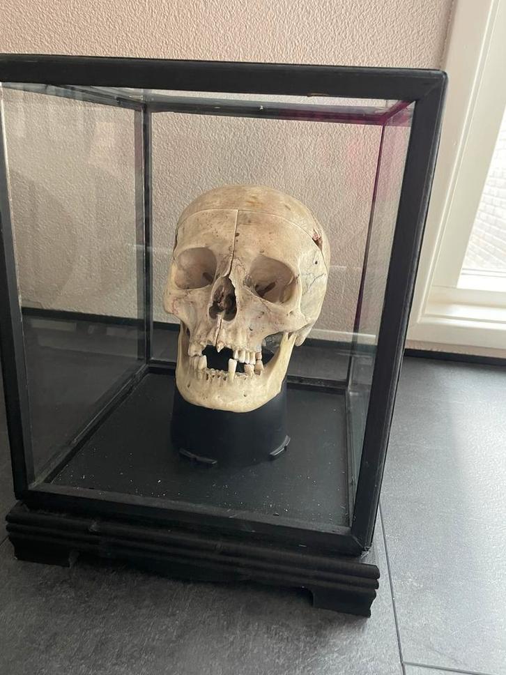 Antieke menselijke schedel met onderkaak, Antiek en Kunst, Antiek | Overige Antiek, Ophalen