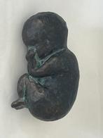 beeld van baby in foetus houding brons met beginnend patina, Gebruikt, Ophalen of Verzenden, Mens