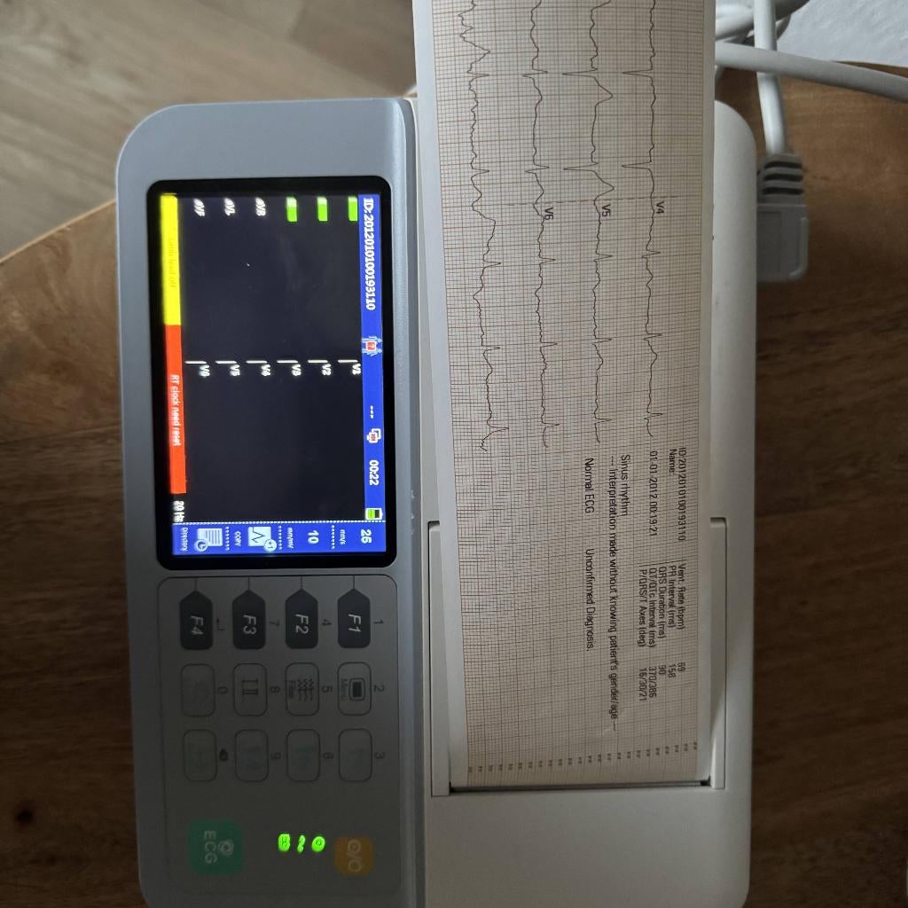 Mindray R3 ECG apparaat (12 afleidingen), Diversen, -, -, Ophalen of Verzenden, Zo goed als nieuw