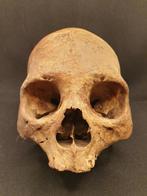 Menselijke schedel en wervelkolom, Antiek en Kunst, Curiosa en Brocante, Ophalen of Verzenden