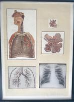 Grote anatomische Schoolplaat de longen / ademhaling 1954, Ophalen of Verzenden, Natuur en Biologie
