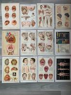 12 medische platen anatomie mond,keel, hart , zwangerschap, Antiek en Kunst, Ophalen of Verzenden