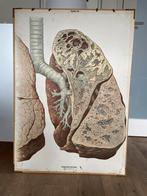 Anatomische schoolplaat, Ophalen, Natuur en Biologie