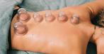 Reiki, Cupping, Massage, Ontspanningsmassage