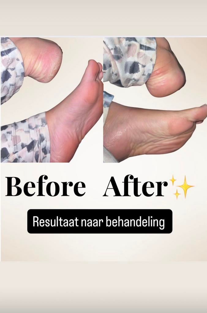 Pedicure Rotterdam Verzorgde voeten & Gellak Butterfly Feet, Diensten en Vakmensen, Schoonheidsspecialisten | Pedicure, Voetmassage