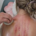 Guasha therapie mens en paard, Sport en Fitness, Massageproducten, Ophalen, Nieuw, Apparaat