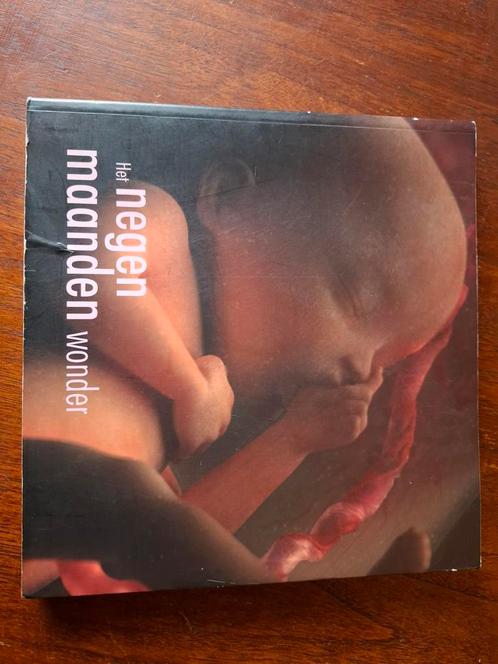 Het negen maanden wonder, Boeken, Auto's | Boeken, Zo goed als nieuw, Ophalen of Verzenden