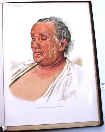 Atlas of Clinical Medicine Vol. 1&2 1892-3 Bramwell Medisch beschikbaar voor biedingen