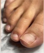 pedicure gespecialiseerd, een enkel plekje vrij, Nagels lakken