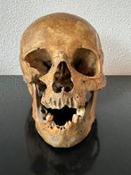 Antieke anatomische mensen schedel skelet medisch, Ophalen of Verzenden