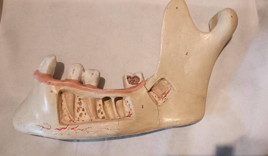 Antiek Medisch Anatomisch model van een kaak Somso, Antiek en Kunst, Ophalen of Verzenden