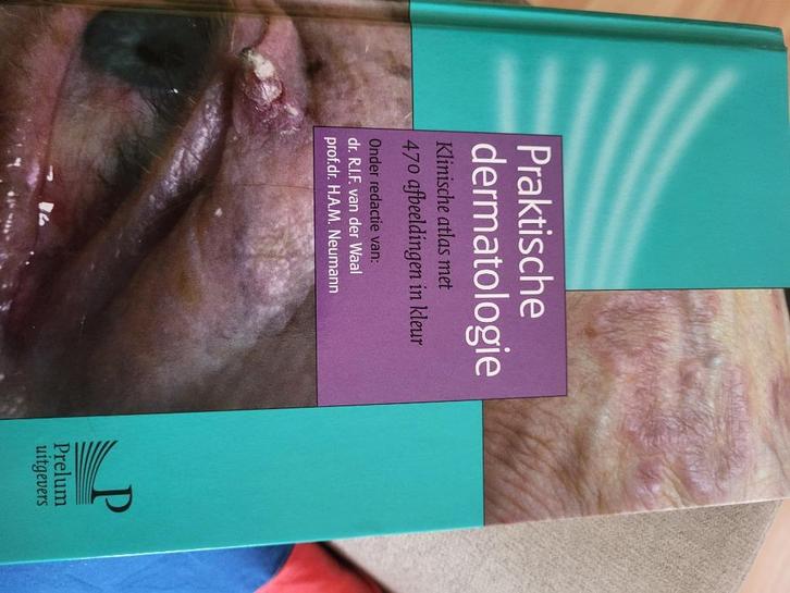 Praktische dermatologieklinische atlas met 470 afbeeldingen, Boeken, Studieboeken en Cursussen, Beta, Ophalen of Verzenden