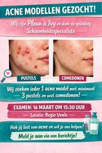 Acne modellen gezocht!, Vacatures, Vacatures | Modellen