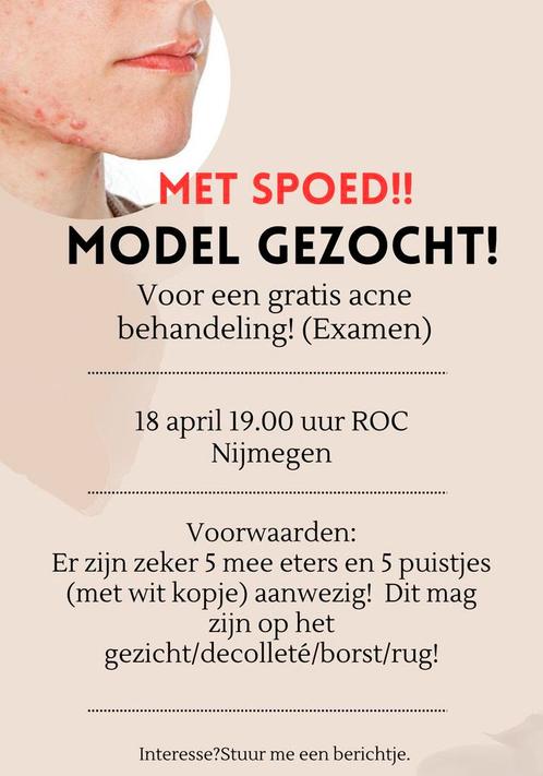 ACNE model gezocht!, Vacatures, Vacatures | Modellen, Overige niveaus, Starter, Overige vormen, Variabele uren