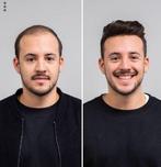 Nieuwe Toupet - Direct Meer Haar!, Ophalen of Verzenden, Nieuw, Pruik of Haarverlenging